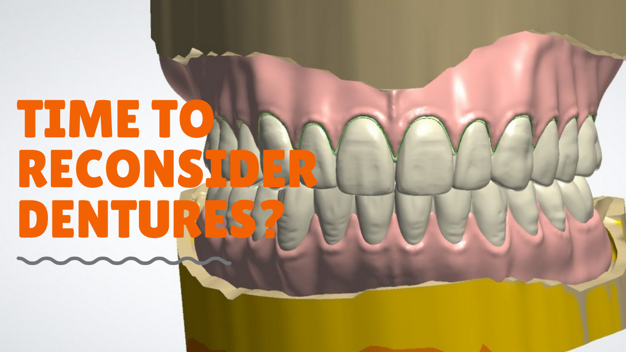 Should You Reconsider Denture Services?